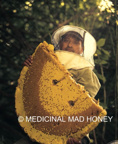 Mad Honey and Lemon: A Natural Remedy for Cough Relief